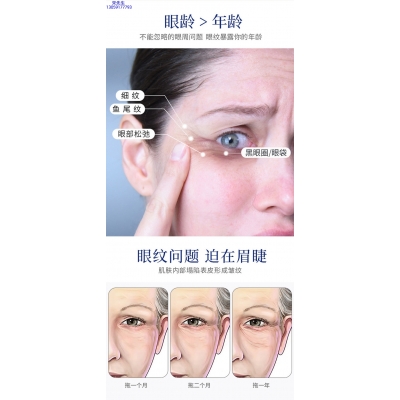 壹美(广州)药业有限公司_美容院玻尿酸微针眼贴